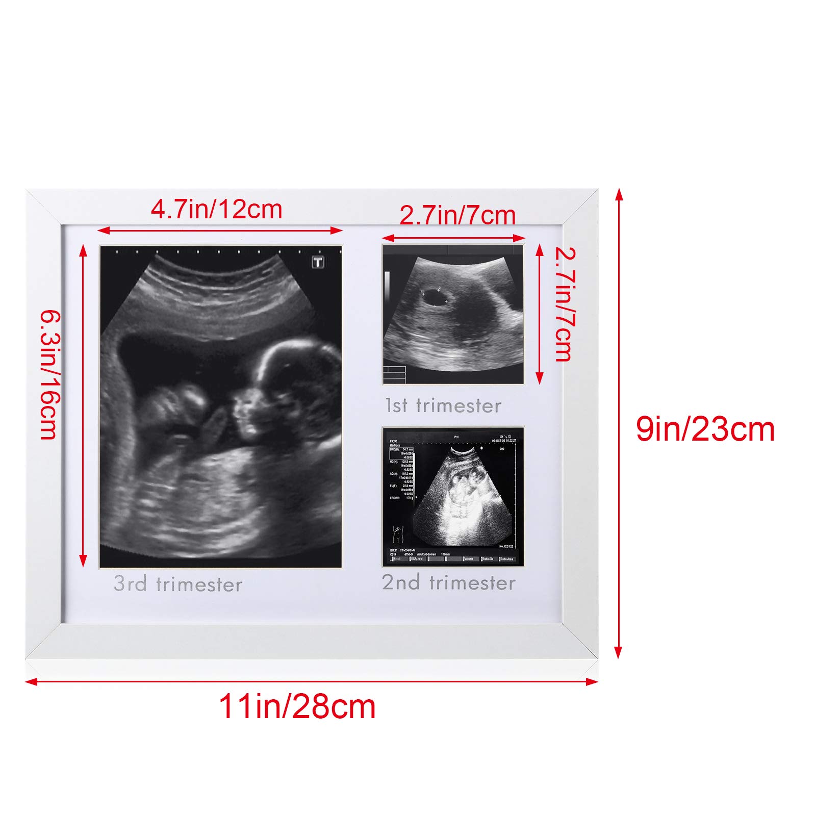 Marco De Fotos Para Ecografía De Bebé - Tamaño 17,5x17,5 Cm, Blanco, Con Soporte De Mesa Y Gancho De Pared, Ideal Para Anunciar Embarazo