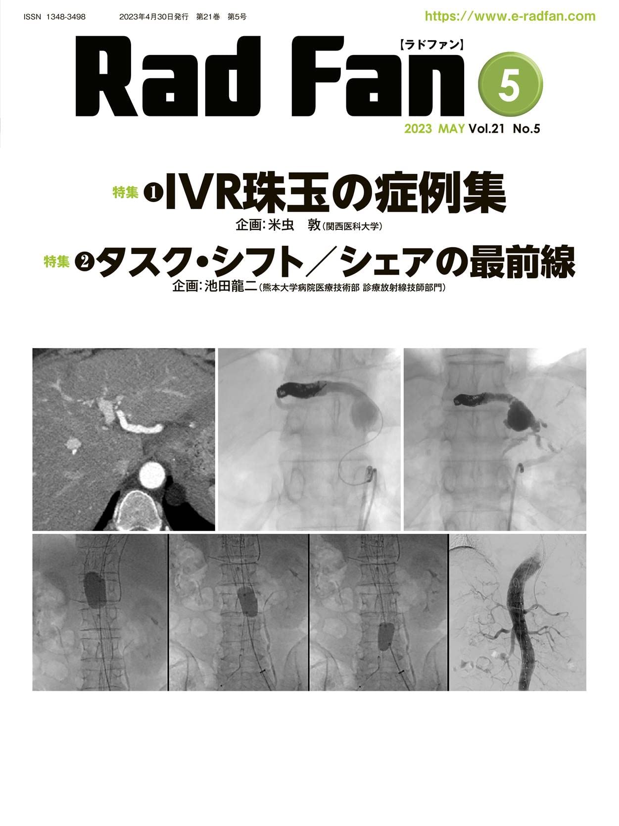 Amazon.co.jp: RadFan2023年5月号 : 株式会社メディカルアイ: Japanese