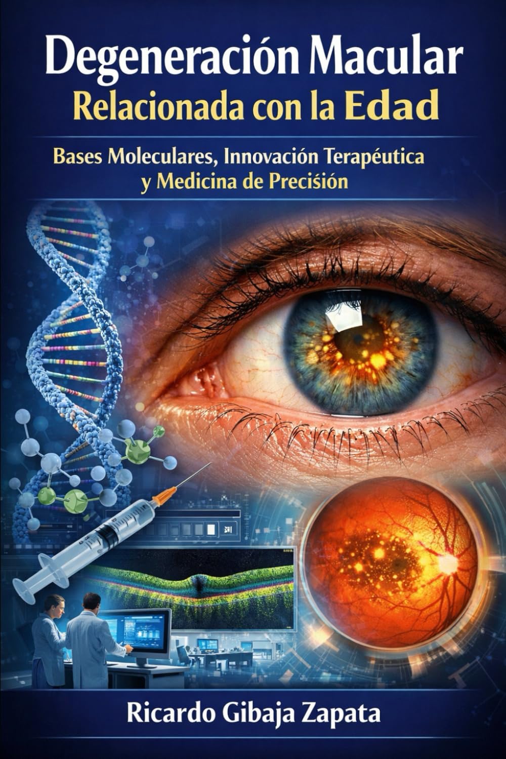 Degeneración Macular Relacionada con la Edad Bases Moleculares, Innovación Terapéutica y Medicina de Precisión