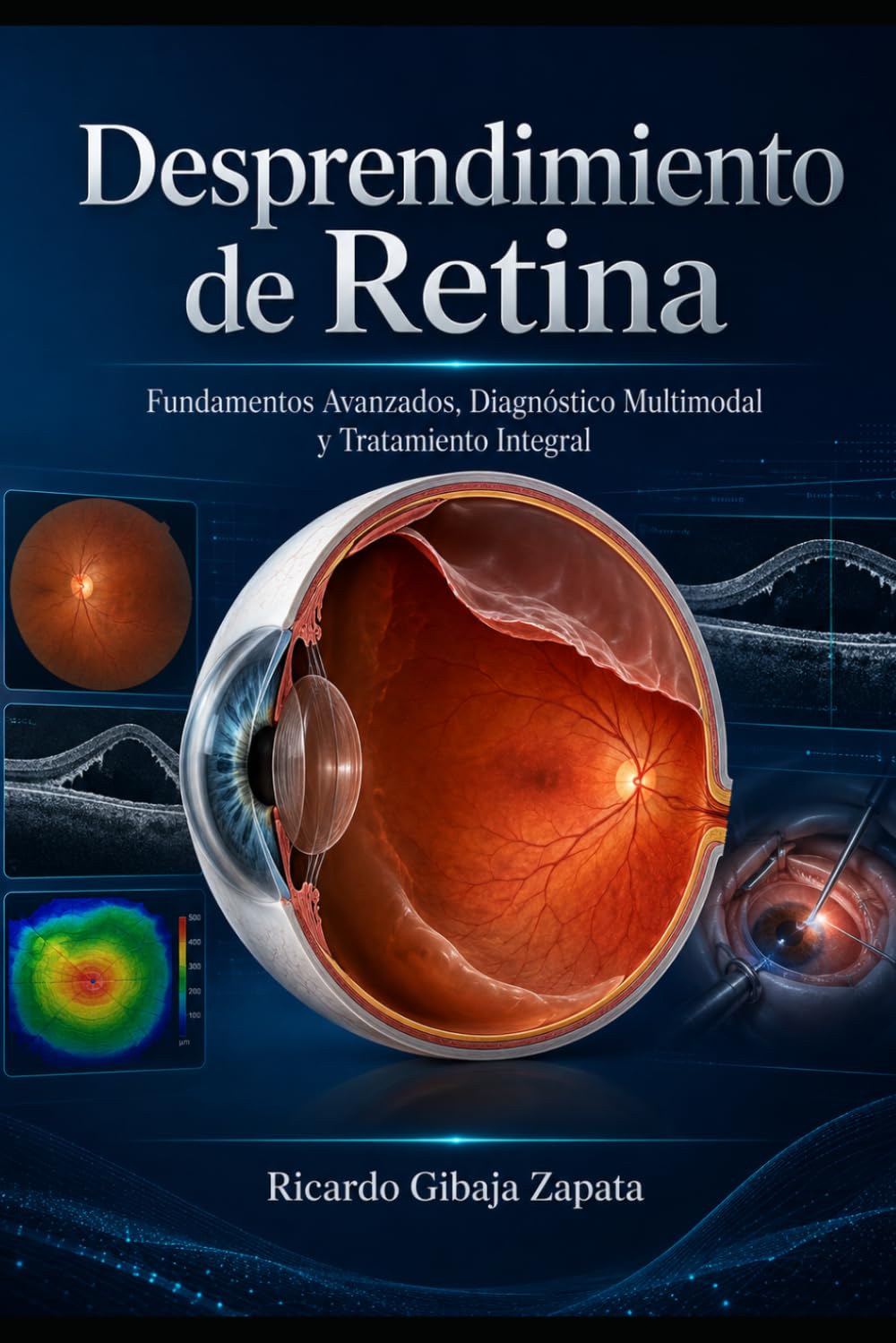 Desprendimiento de Retina: Fundamentos Avanzados, Diagnóstico Multimodal y Tratamiento Integral