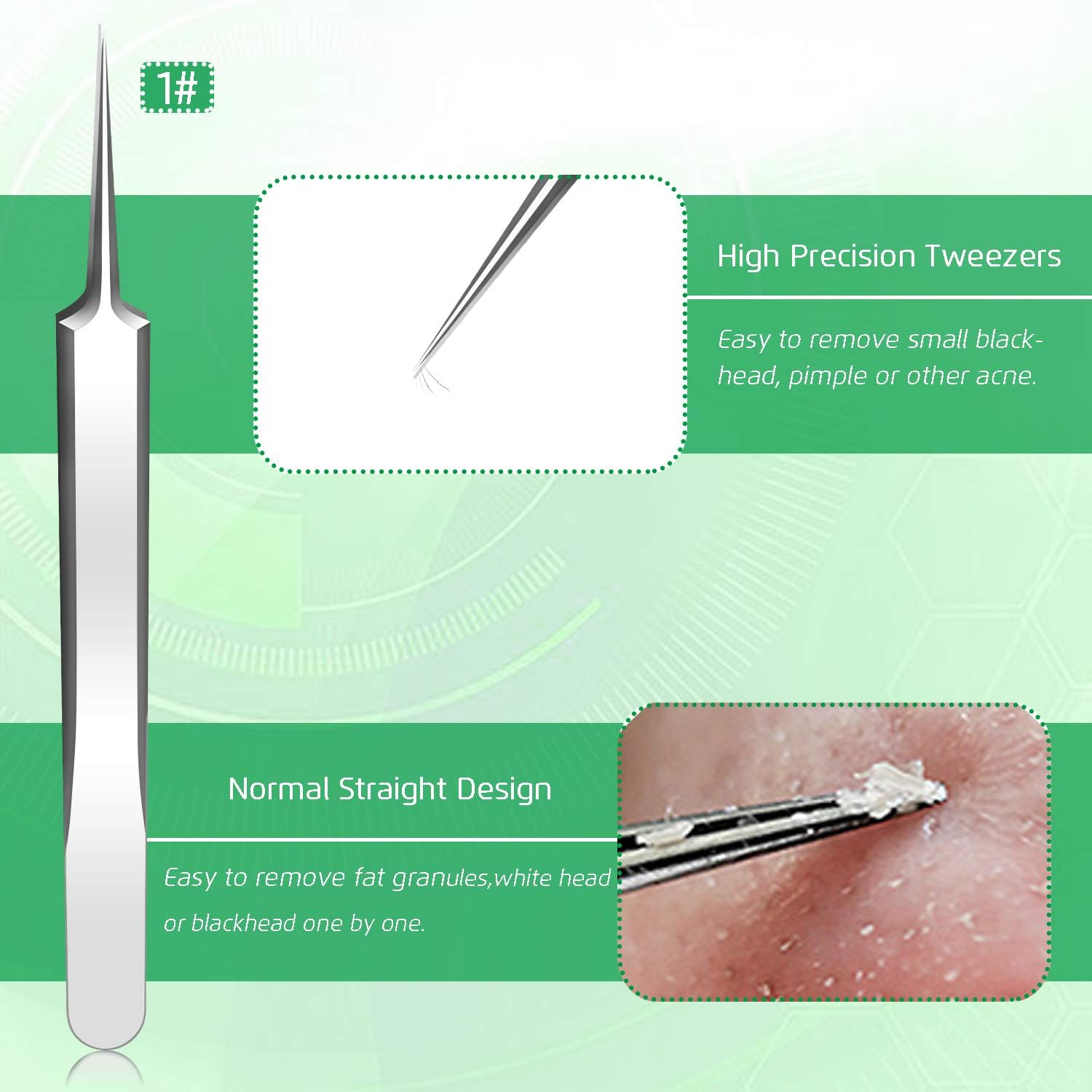 5PCS Blackhead Remover, Pimple Removal Tools, Blemish Whitehead Popping Removal, Whiteheads Spot Removing Zit Tool, Curved Blackhead Tweezers Kit, Treatment for for Risk Free Nose Face Skin : Beauty & Personal Care