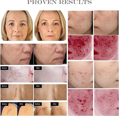 Miniatura 5 de Polvo básico de factor de crecimiento de fibroblastos - bFGF polvo liofilizado grado cosmético para piel antienvejecimiento, 1 miligramos,