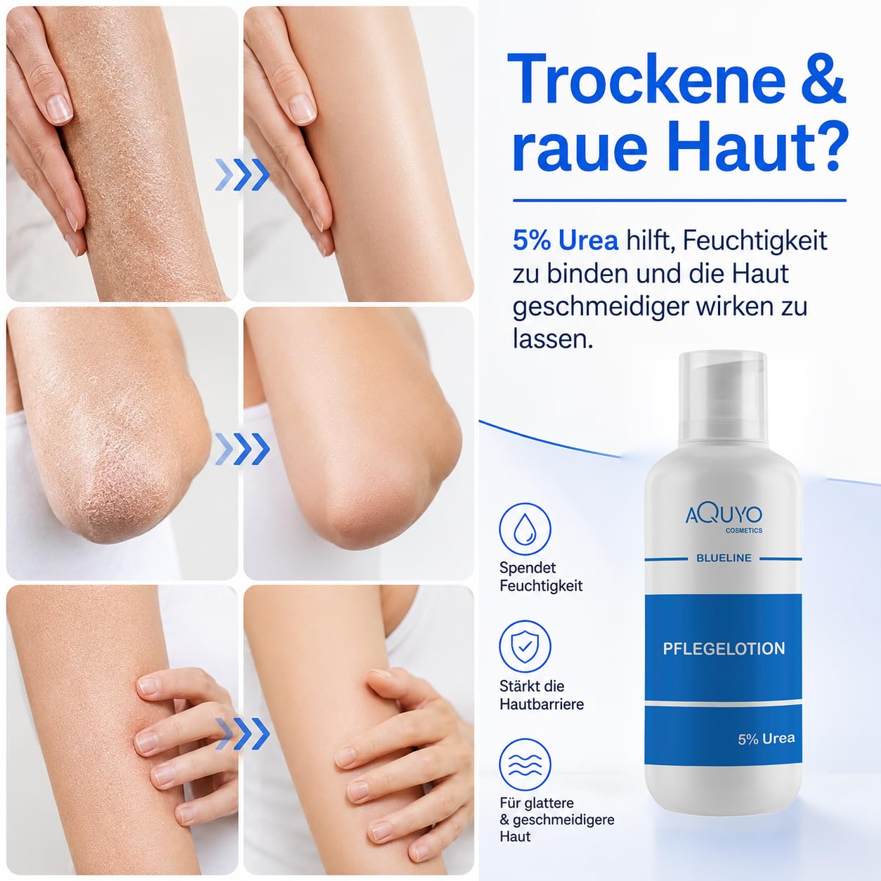 Blueline 5% Urea Creme Lotion, Körperlotion für trockene Haut, Feuchtigkeitslotion bei empfindlicher Haut, Neurodermitis, Juckreiz oder Psoriasis, Bodylotion zur Hautpflege (3x 500ml)