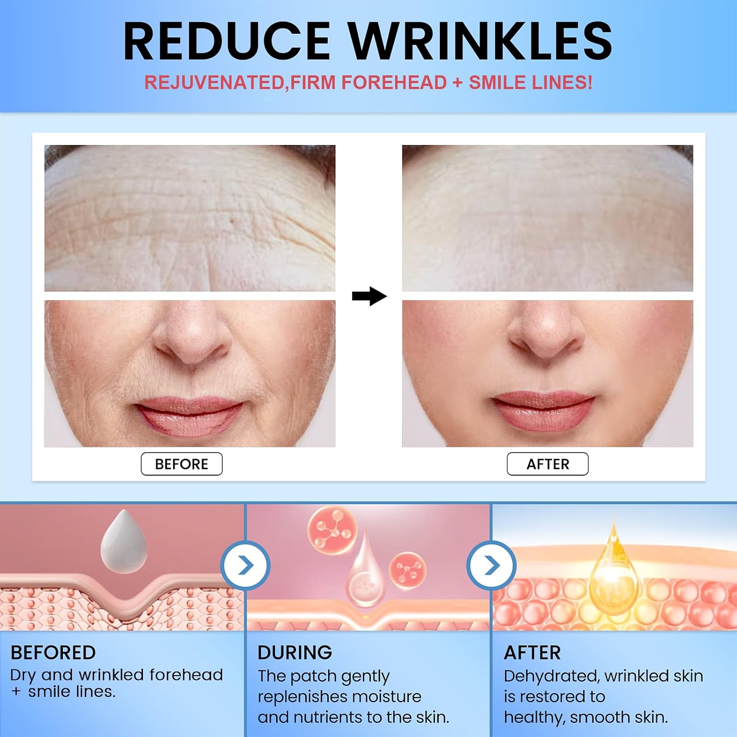 Tripsky Forehead Wrinkle Patches, Smile Line Patches, Wrinkle Patches Overnight Smoothing Facial Wrinkle Patch, Lift Lines for Women & Men (White)