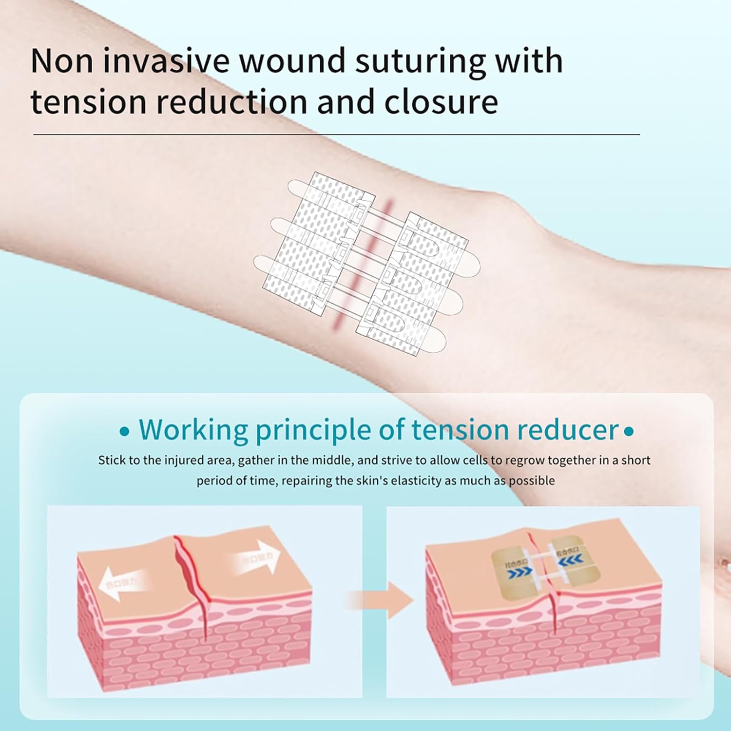Wound Closure Strips Zip Stitch Sutures Butterfly Bandaids Emergency Laceration Closure Kit for Lacerations Incisions Cuts(20X8CM)