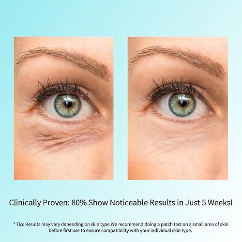 Miniatura 4 de SEACALL Crema de ojos con retinol con cafeína y vitamina C, tratamiento de suero antienvejecimiento para ojeras, arrugas e hinchazón, sin fragancia,