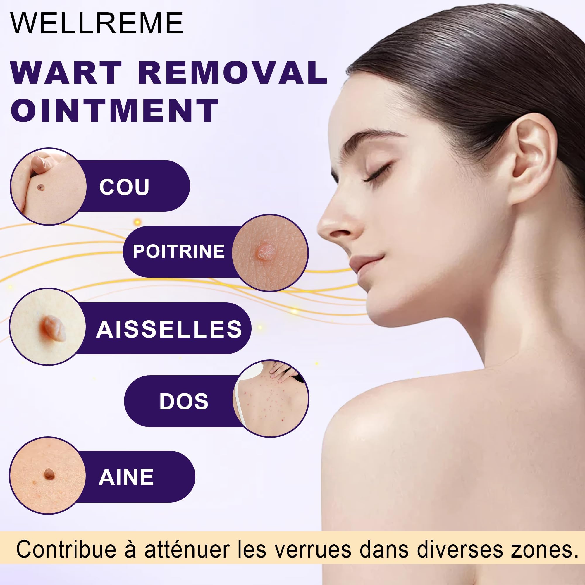 Crema para eliminar verrugas 20g, quita verrugas, verrugas plantares, adecuada para diferentes tipos de piel