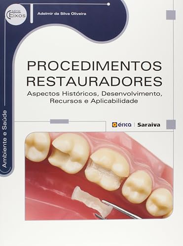 Procedimentos restauradores: Aspectos históricos, desenvolvimento