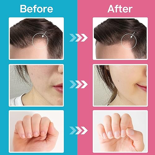 Miniatura 5 de Suplemento para el crecimiento del cabello con biotina de 5000 mcg para un cabello, piel y uñas más fuertes y saludables, apoya la energía, el