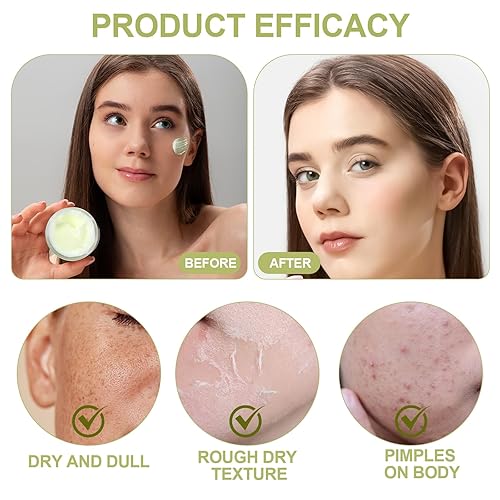 Miniatura 8 de Crema de neuropatía, crema de magnesio para neuropatía, hidrata profundamente la piel, apta para todo tipo de piel