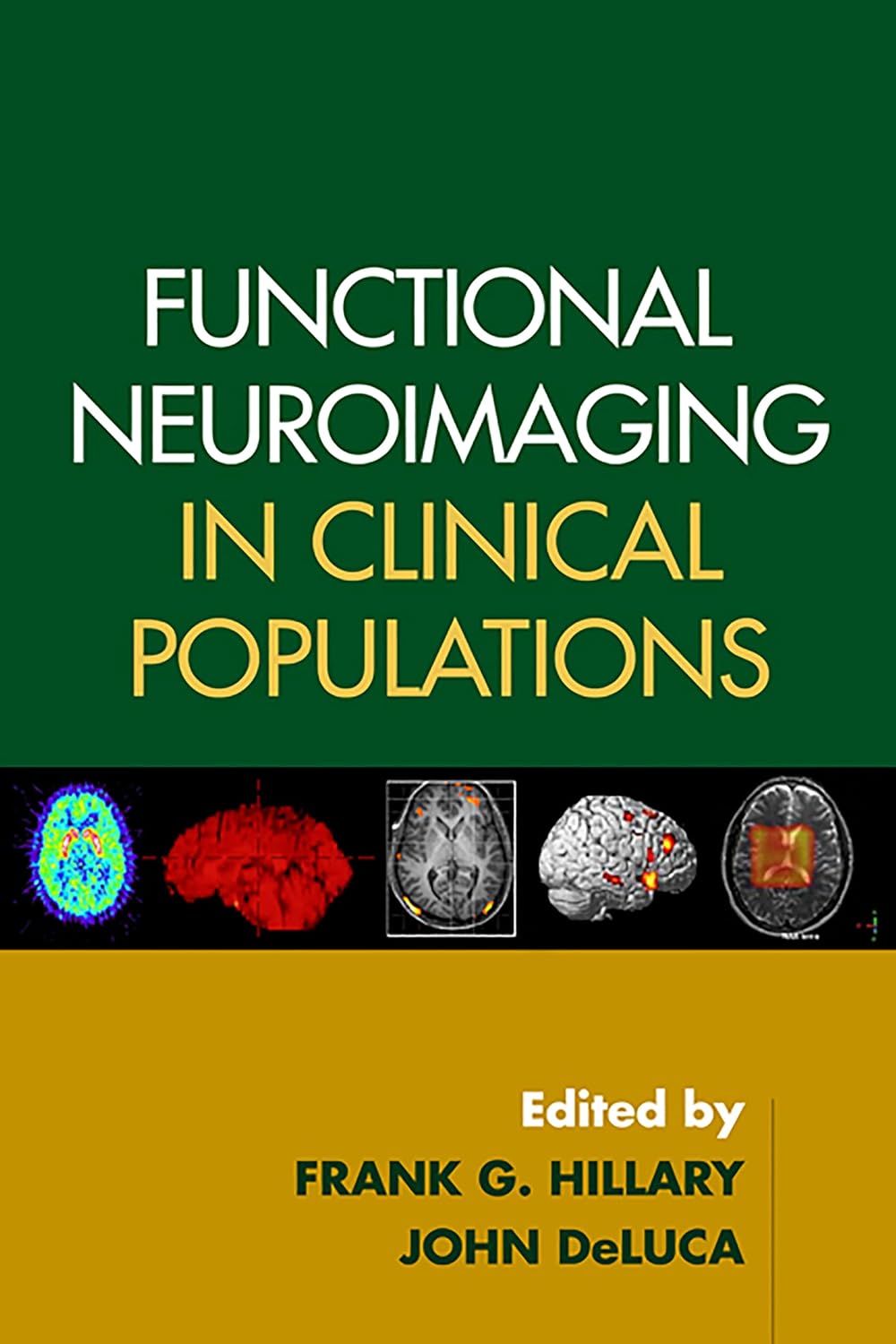 Functional Neuroimaging in Clinical Populations 9781593854799