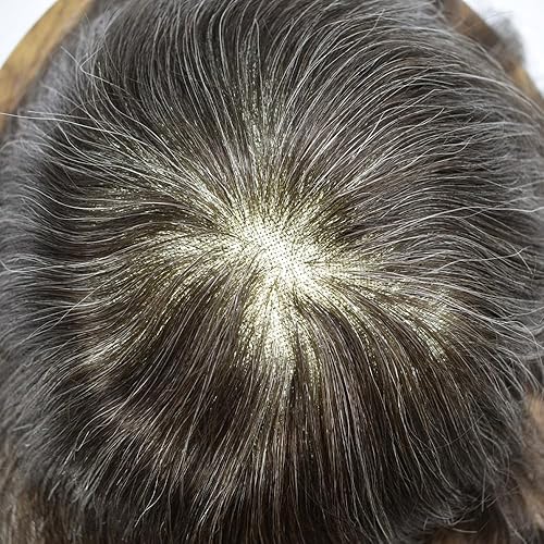 Miniatura 10 de Toupee para hombres Piezas de pelo suizo encaje real Cabello humano reemplazo sistema Mens Toupee hombres sistema de pelo prótesis para hombres 6x8