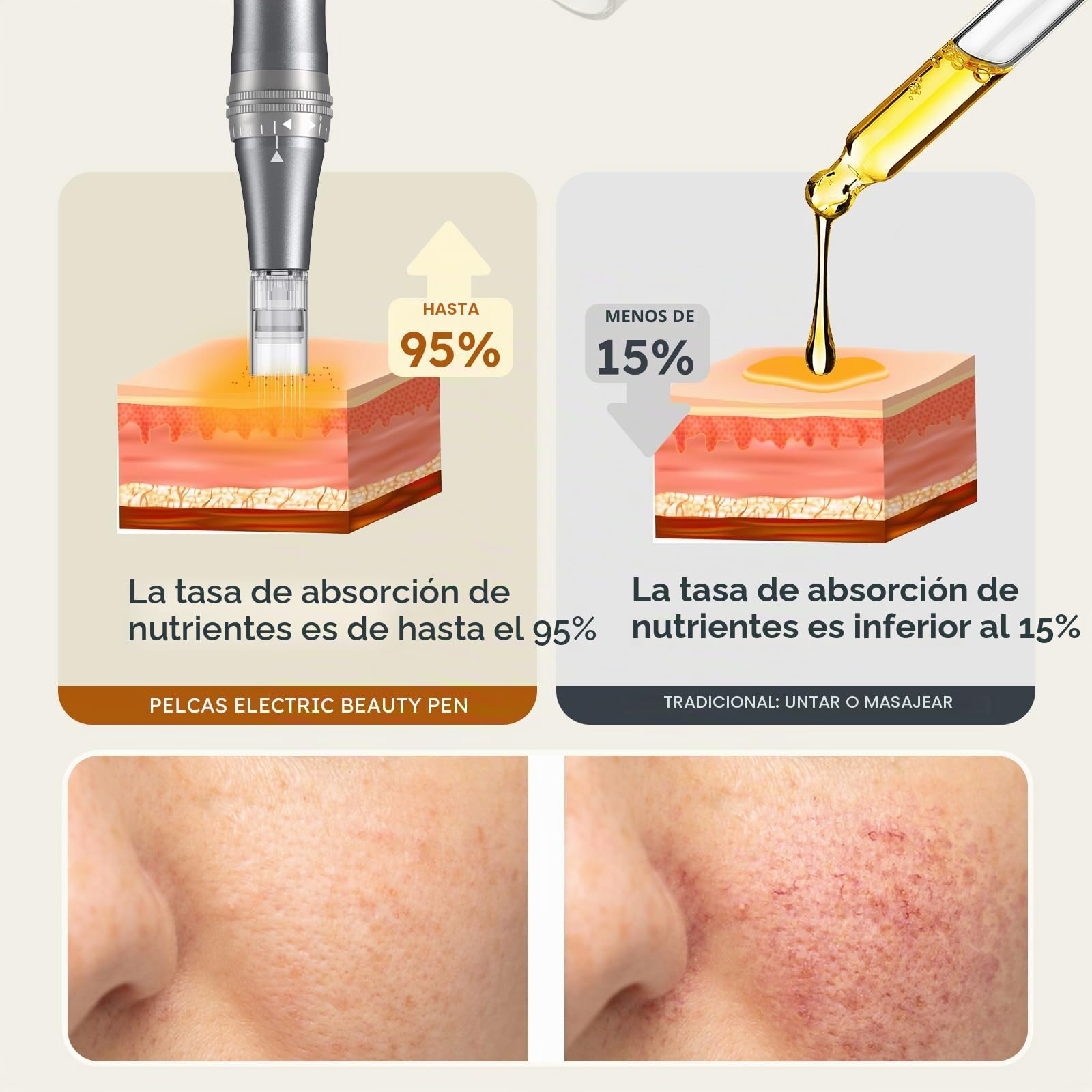 PELCAS 9 Velocidades Dermapen con Pantalla LCD Dermapen Profesional con 12 Cartuchos Derma Pen Recargable Tipo C para el Cuidado de la Piel-Negro