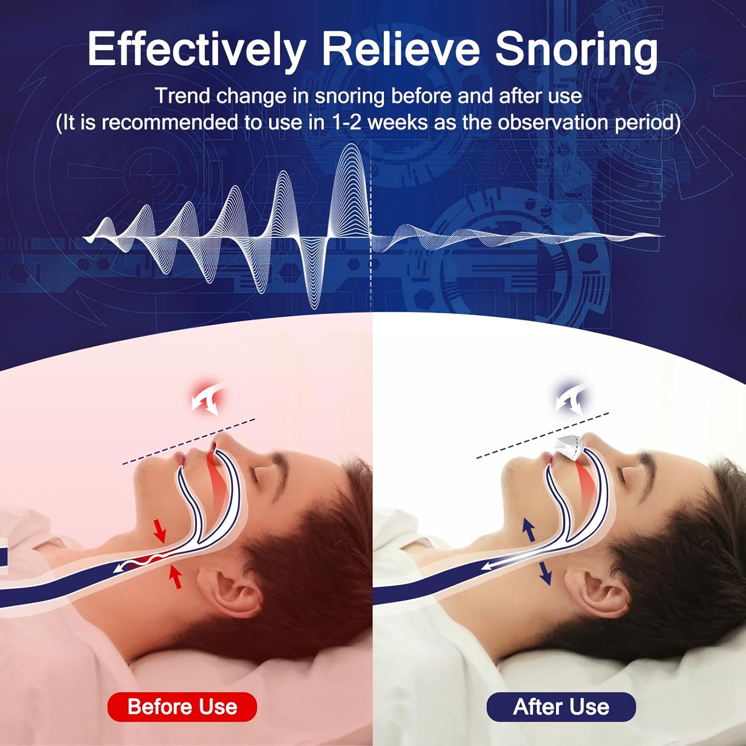 Electric Anti Snore Device, Adjustable Wind Speed Snoring Solution, Mini Anti Snoring Devices Nose Vents Plugs,Stop Snoring for Men & Women - Image 2