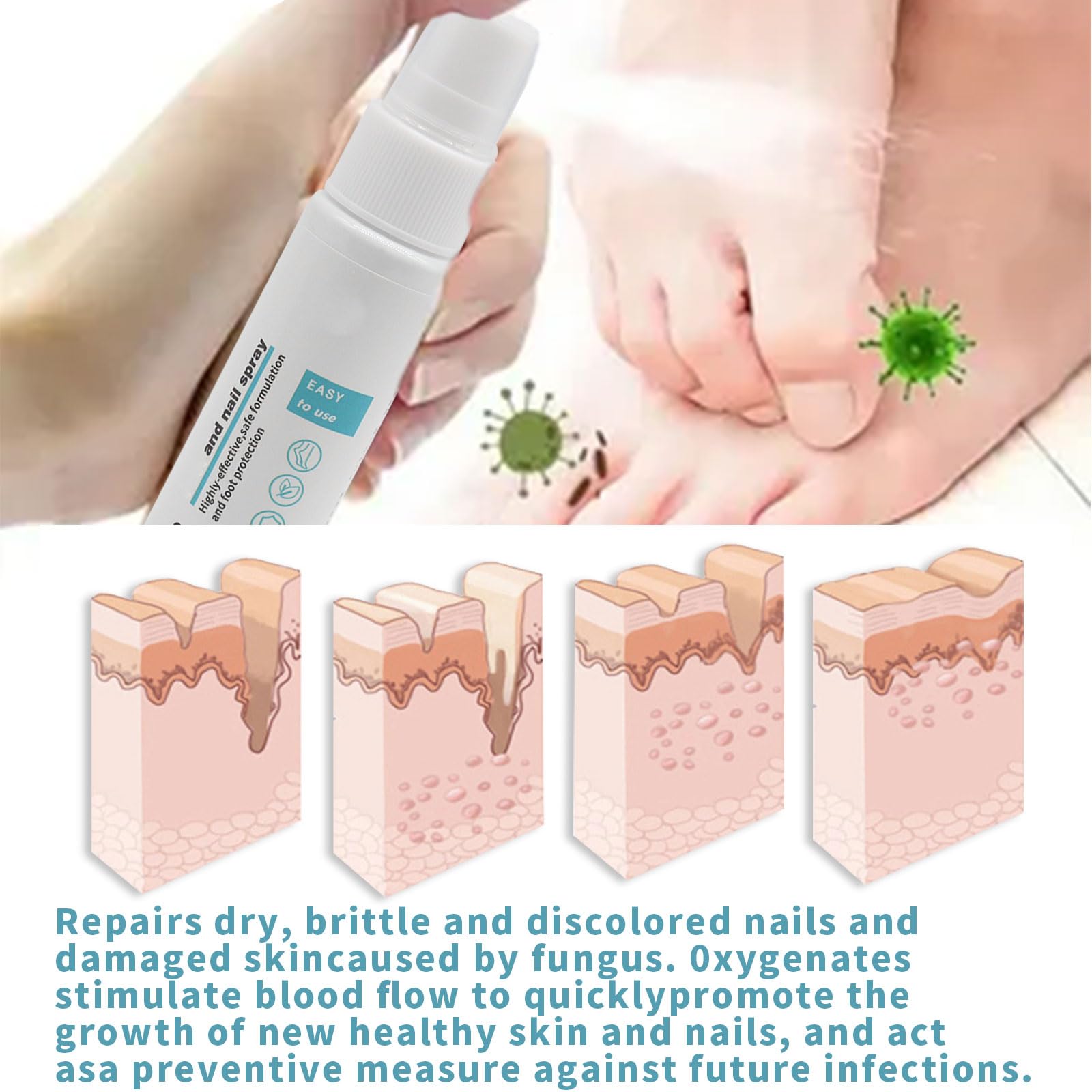 2 x 30ml Spray Contra Hongos En Los Pies, Spray Fungicida Contra Hongos En Los Pies, Tratamiento De Hongos En Los Pies Spray Protector Para El Cuidado De Las Uñas y Los pies, Alivia El Picor