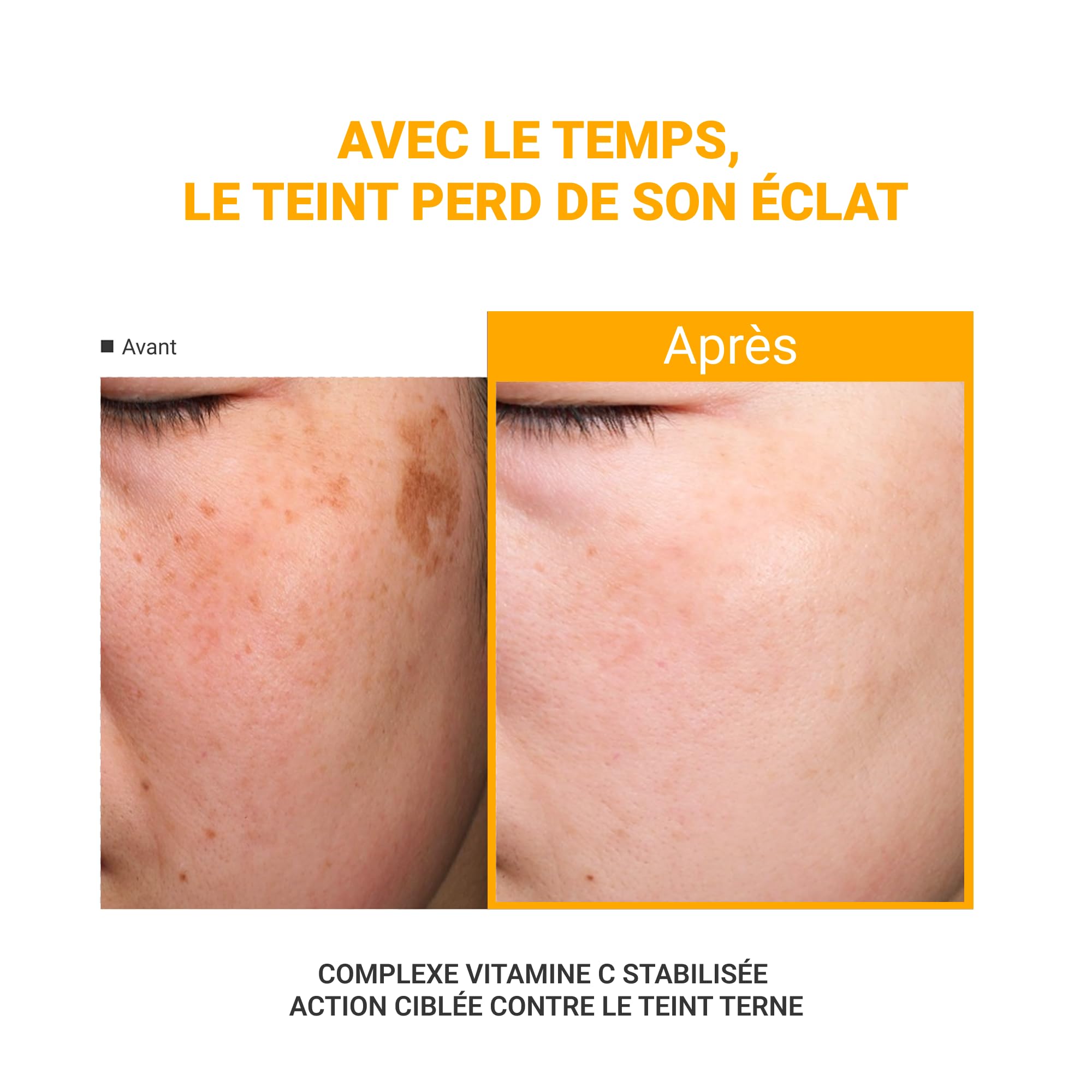 Differ&Deeper Ampułki Witamina C, Glutation & Niacynamid – Koreańskie Serum na Przebarwienia, Anti-Ciemne Plamy & Blask, Kuracja | 10 x 2,5 ml