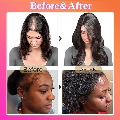 Miniatura 5 de Batana - Aceite natural para el crecimiento del cabello, 100% sin refinar, 4.1 fl oz, promueve y restaura el grosor, reduce la pérdida y las puntas