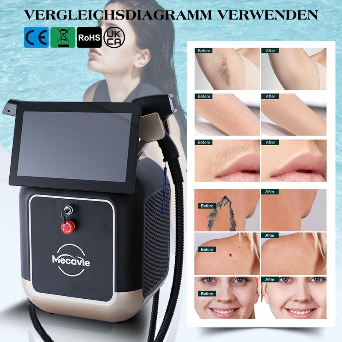Dispositivo de belleza profesional 2 en 1, máquina de depilación, suavizado corporal, aclarado de manchas y herramienta revitalizante para el cuidado de la piel, rejuvenecimiento y esquia
