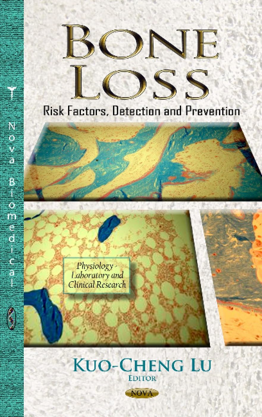 Bone Loss: Risk Factors, Detection and Prevention (Physiology - Laboratory and Clinical Research)