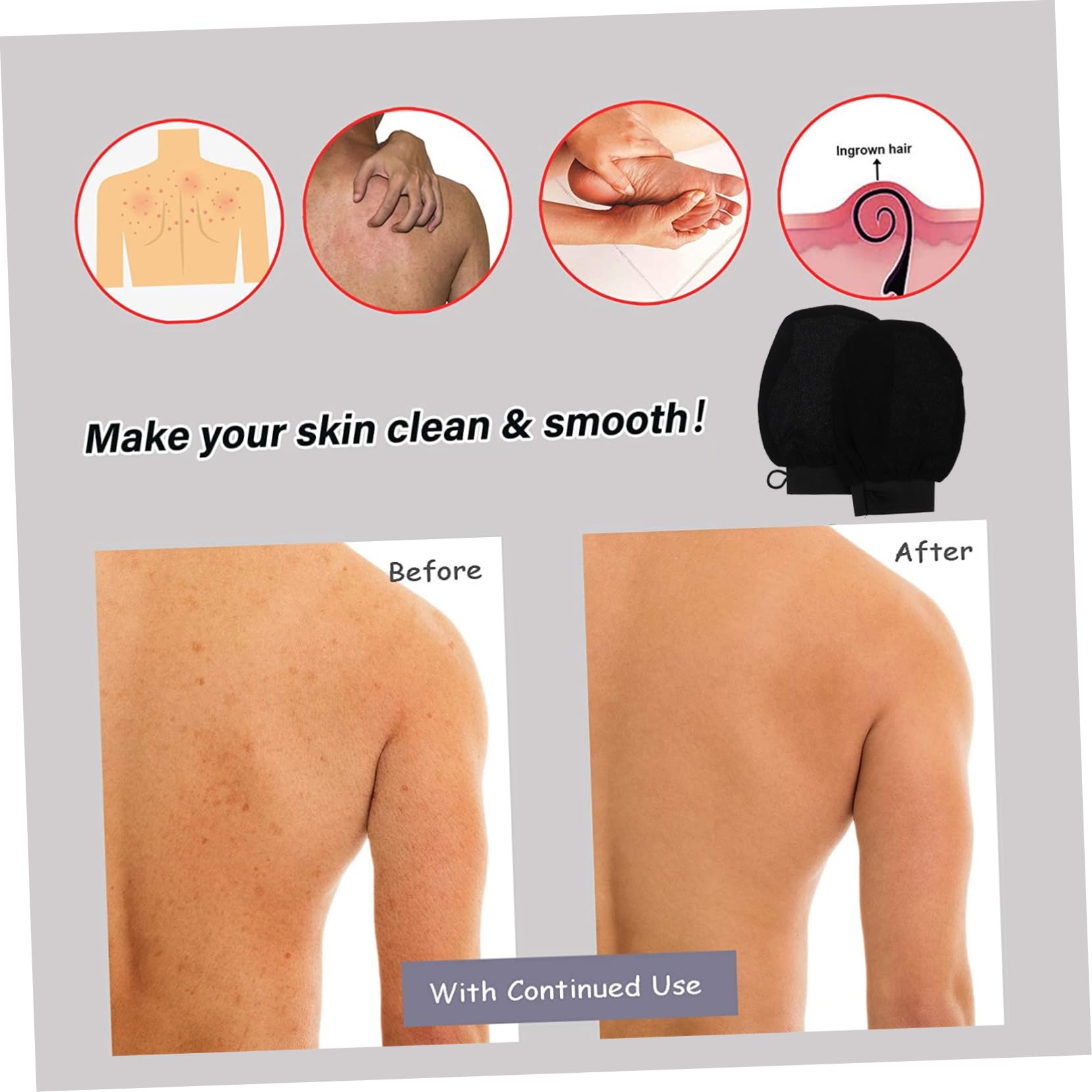 Gogogmee Dead Skin Remove Bath Gloves Set Hand Exfoliating Scrub Glove for Shower
