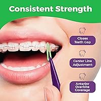 Vista 3 de Bandas de goma elásticas ortodónticas de 5/16 pulgadas, paquete de 100, neón, tamaño mediano, 3.5 onzas, bandas de goma pequeñas para rastas