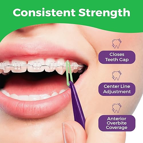 Miniatura 6 de Bandas de goma elásticas ortodónticas de 516 pulgadas, paquete de 100, naturales, pesadas de 4.5 onzas, pequeñas bandas de goma para rastas para el