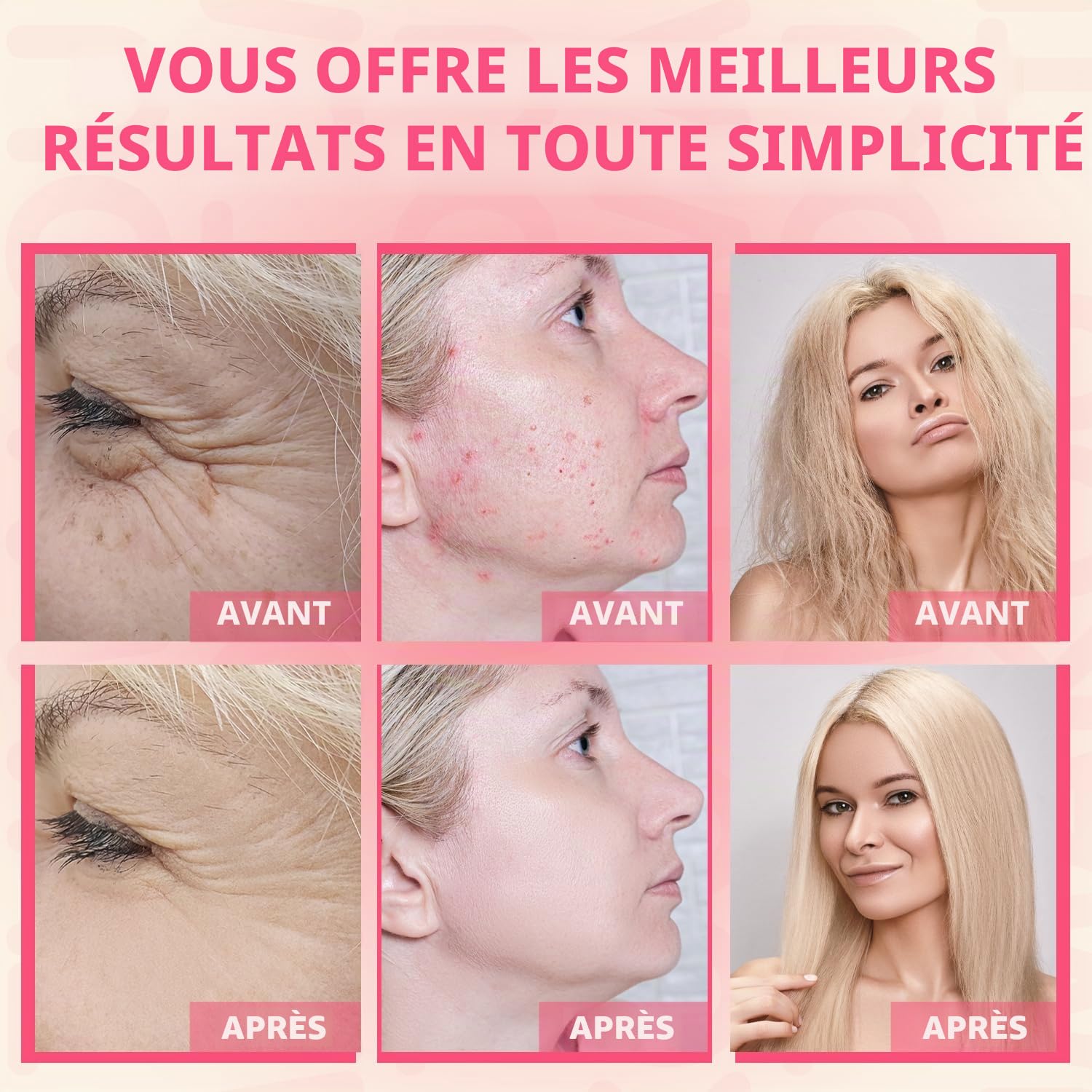 Appareil Haute Frequence Esthetique: TUMAKOU Appareil Visage | Avec 4 Electrodes pour Soins pour le Visage