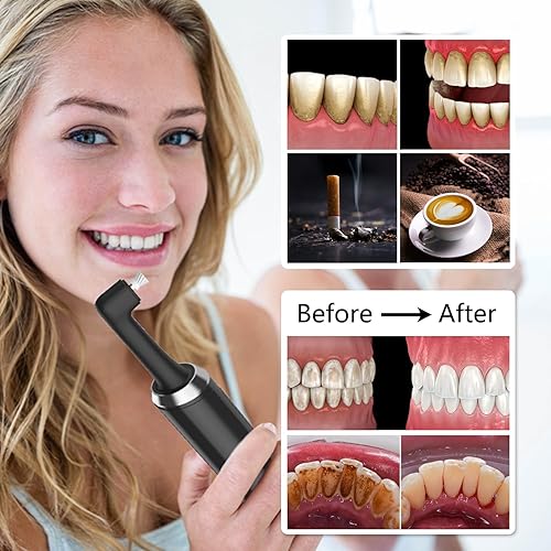 Miniatura 4 de Pratuor Kit de pulidor de dientes recargable para limpieza diaria, blanqueamiento y pulido, pulidor dental eléctrico con luz LED, 6 cabezales de
