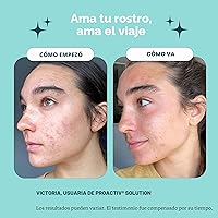 Vista 3 de Kit de principiante, sistema de tratamiento acné de 3 pasos PROACTIV (30 días)