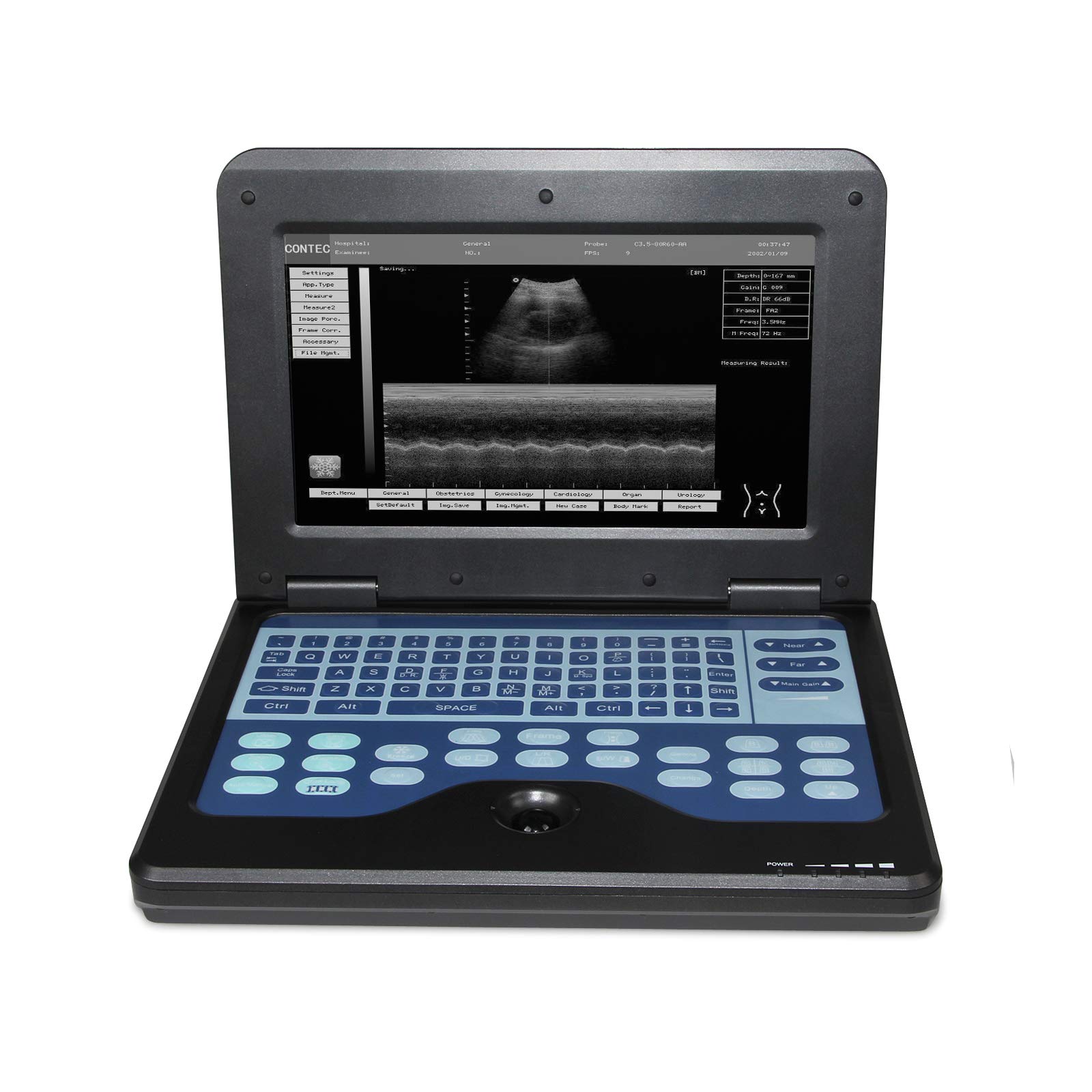 CONTEC MED CMS600P2 Portable Laptop B-Ultra Sound Scanner Machine (Micro-Convex Probe)