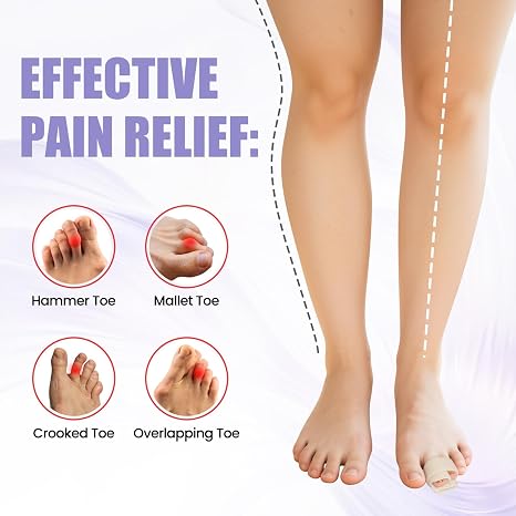 Hammer Toe Straightener for Women & Men - Broken Toe Wraps, 2 Pcs Hammer Toe Corrector, Toe Splint Relief for Broken Toes, Crooked Toes & Overlapping Toes (Beige)