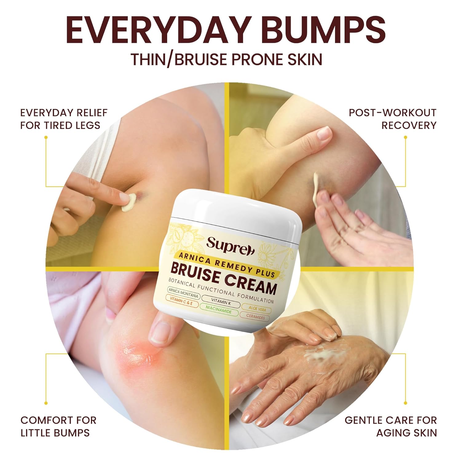 SupreH Arnica Bruise Cream Extra Strength: Vitamin K C & E for Bruising, Swelling and Niacinamide Ceramide for Discoloration & Thin Skin