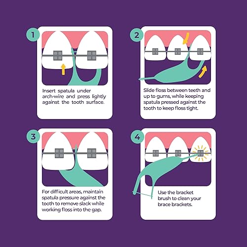 Miniatura 8 de Platypus Hilo dental de ortodoncia para aparatos ortopédicos  Púas Ortho para adultos y niños  Se adapta debajo del alambre del arco  No daña