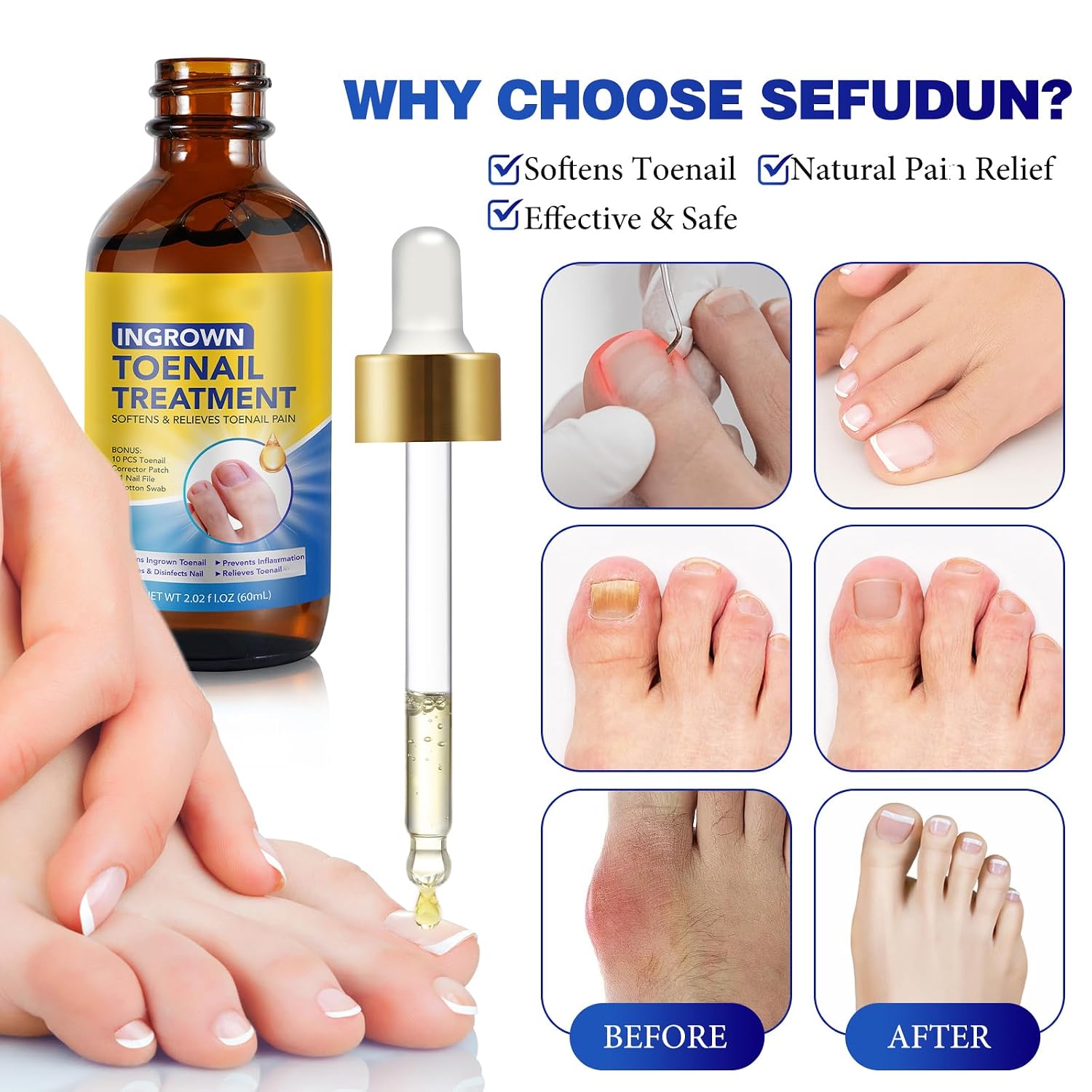 Nail Removal Kit,Toenail Drops,Softens Nails,Nail Care Tool Set,Ingrown Toenail Corrector,Corrector Patch,Nail File,60ml