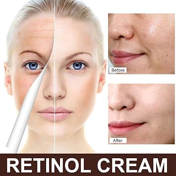 Retinol Anti Wrinkle Removal Skin Firming Cream, 1.0 oz 30 g Retinol Face Moisturizer, Tightens Skin, Smooths Fine Lines, Retinol Anti Wrinkle Cream for Women 3pcs