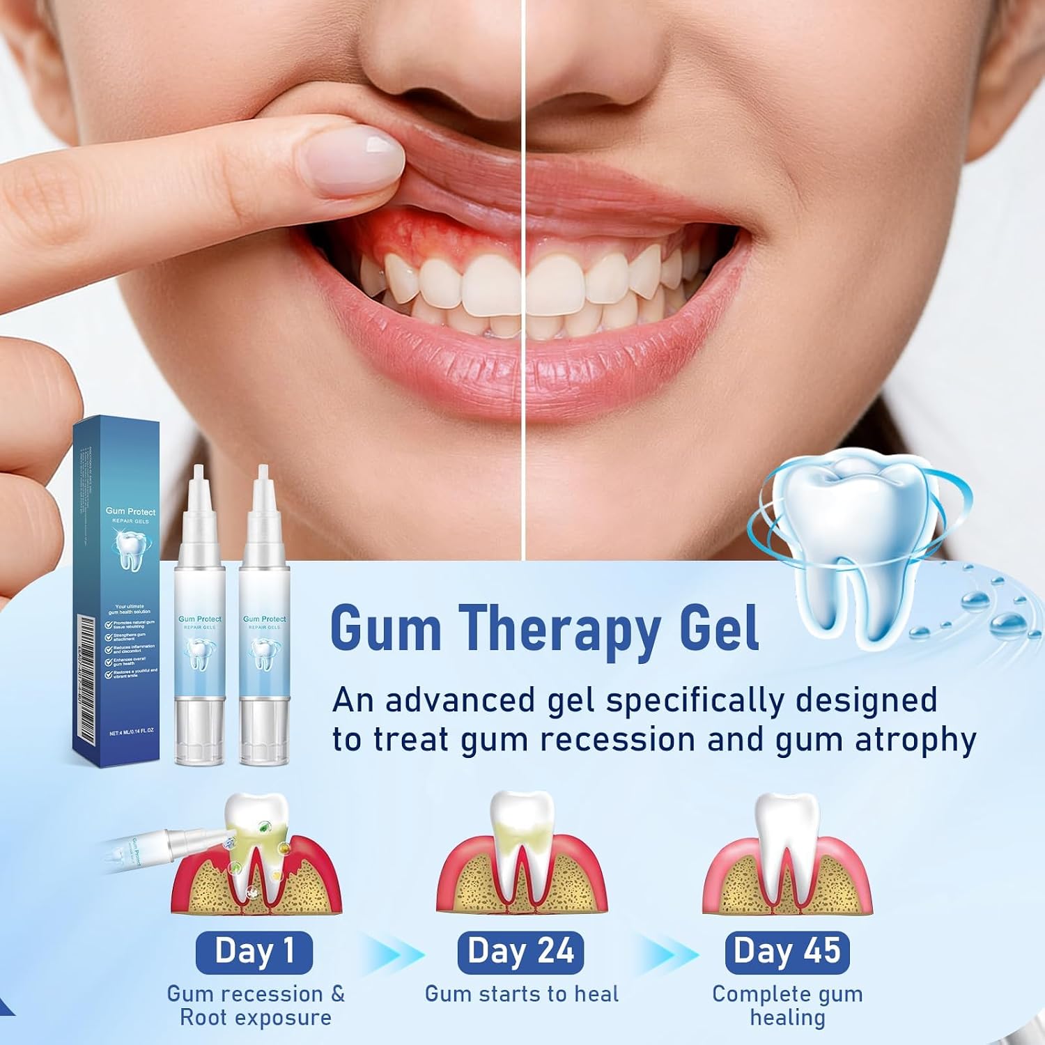 Gum Protect Repair Gel, Gum Instant Soothing Gel, Teeth Whitening Essence Pen, Rapid and Effective Oral Protection Solutions, 2 Pack, 4ml Each