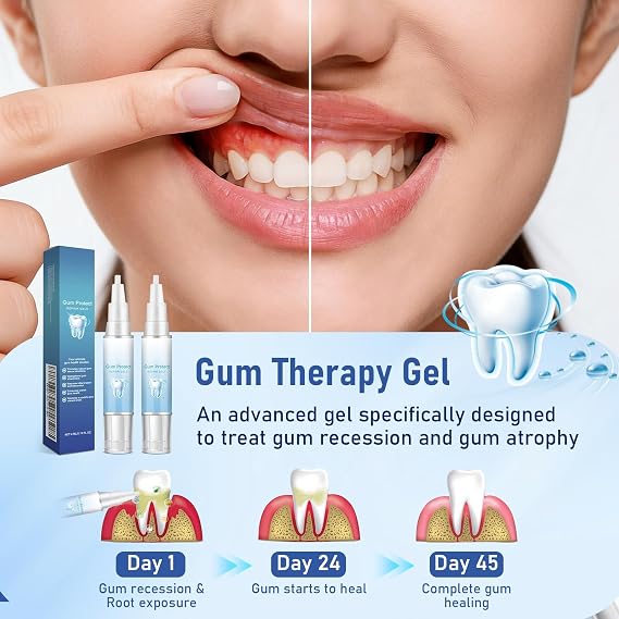 Gum Protect Repair Gel, Gum Instant Soothing Gel, 2 Pack