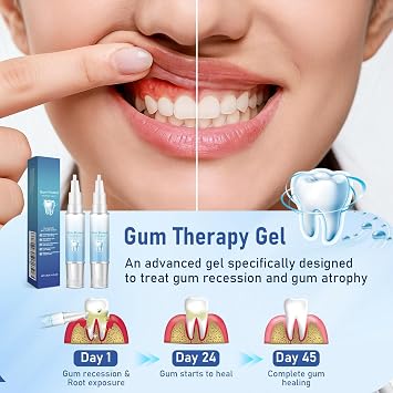 Gum Protect Repair Gel, Gum Instant Soothing Gel, 2 Pack