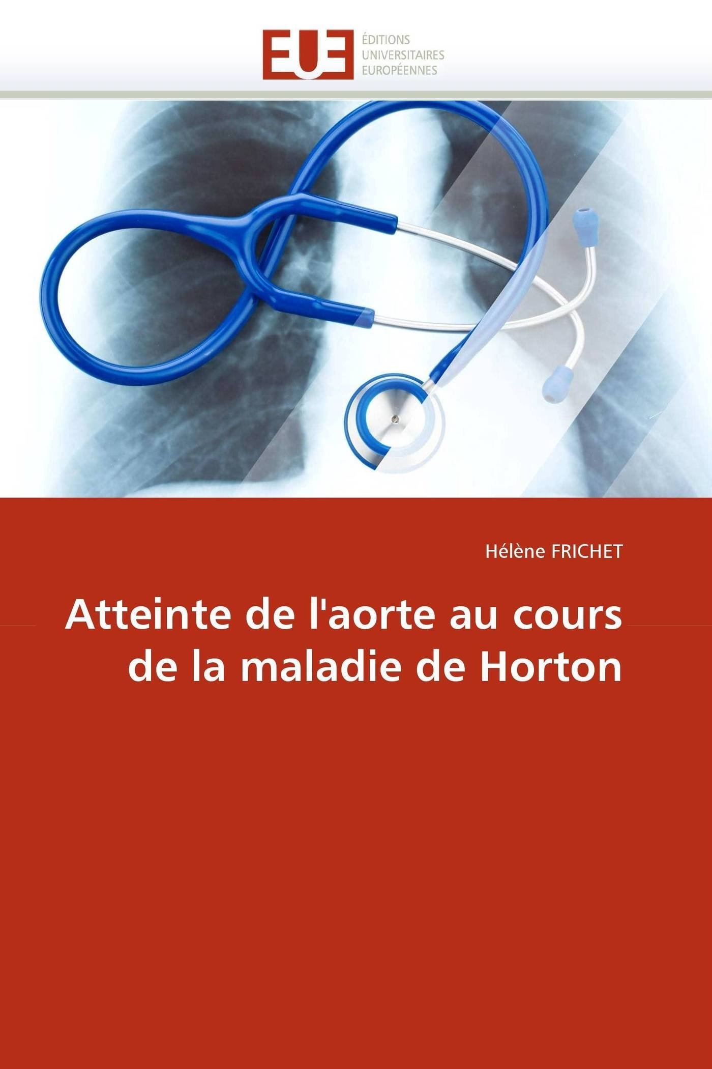 Atteinte de l'aorte au cours de la maladie de Horton (Omn.Univ.Europ.)
