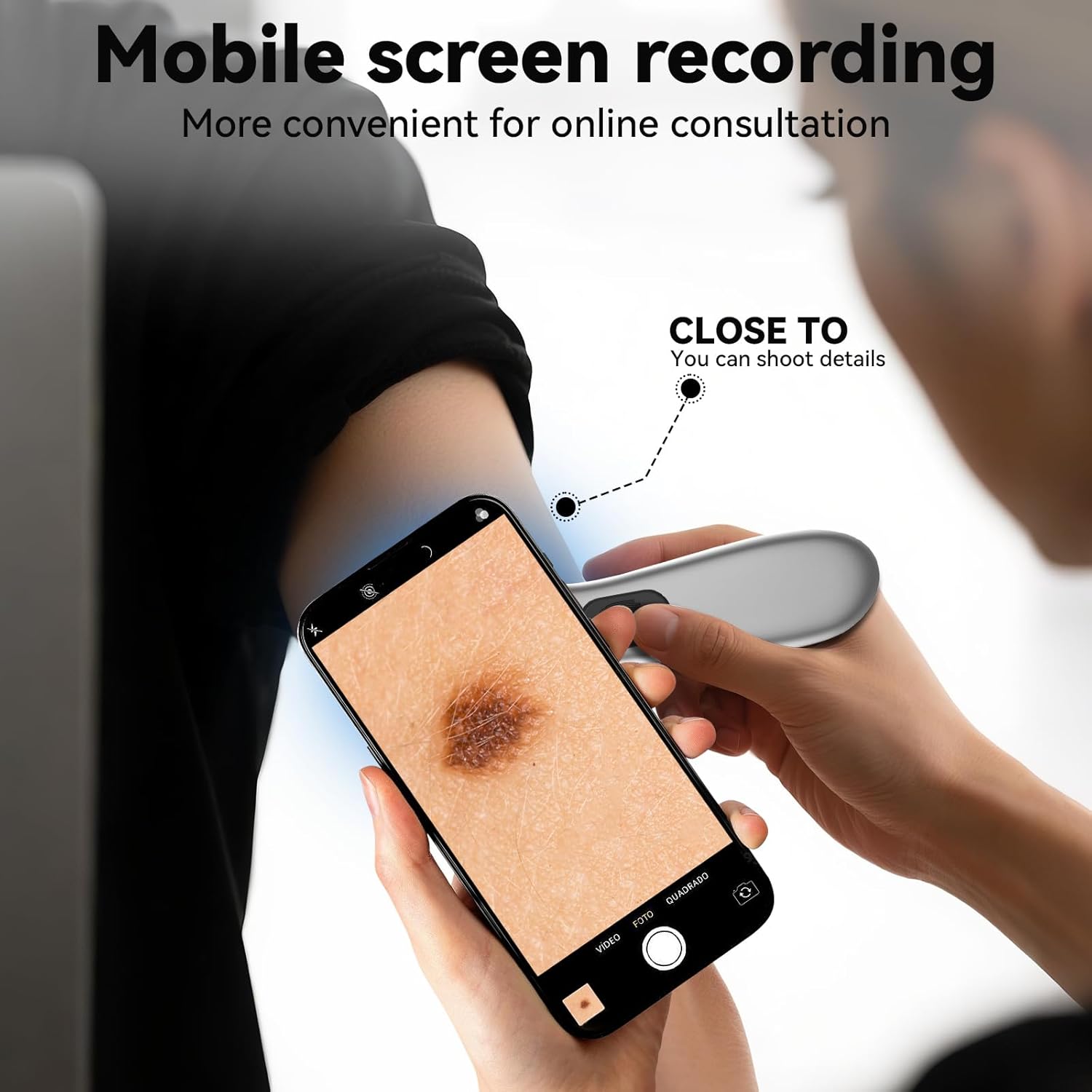 Rechargeable Polarized Dermatoscope, 10x Magnification Pocket Skin Analyzer Light for Dermatology and Epiluminescence Examination