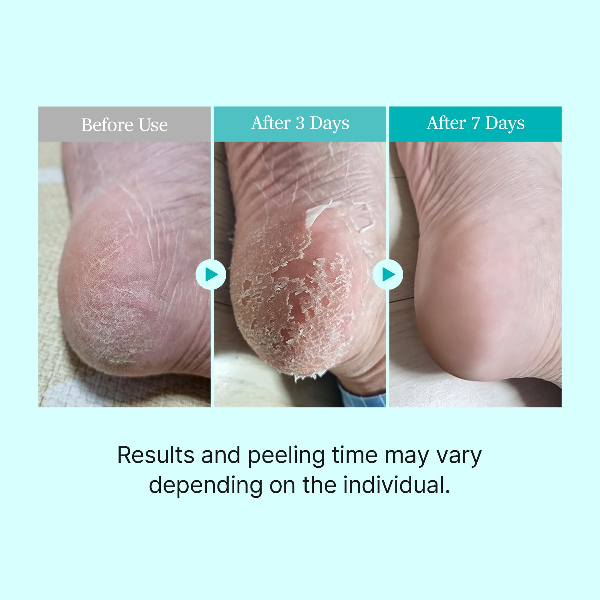 Ariul Smooth & Pure Softening Foot Peeling Mask Sheet 2 pairs - Çorap Tipi Deri Yumuşatan Ayak Peeling Maskesi 2 çift