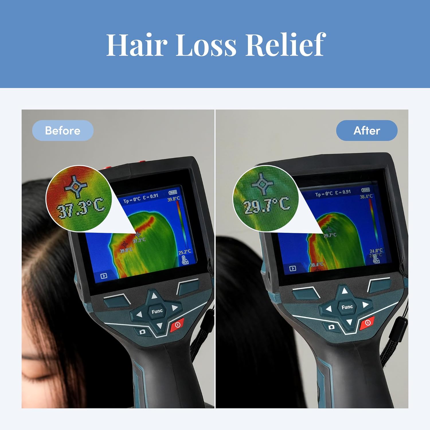 CURLYSHYLL Root Remedy Scalp Tonic | Scalp Cooling & Comfort Care with Botanical Extracts | Lightweight Daily Scalp Essence | 100ml