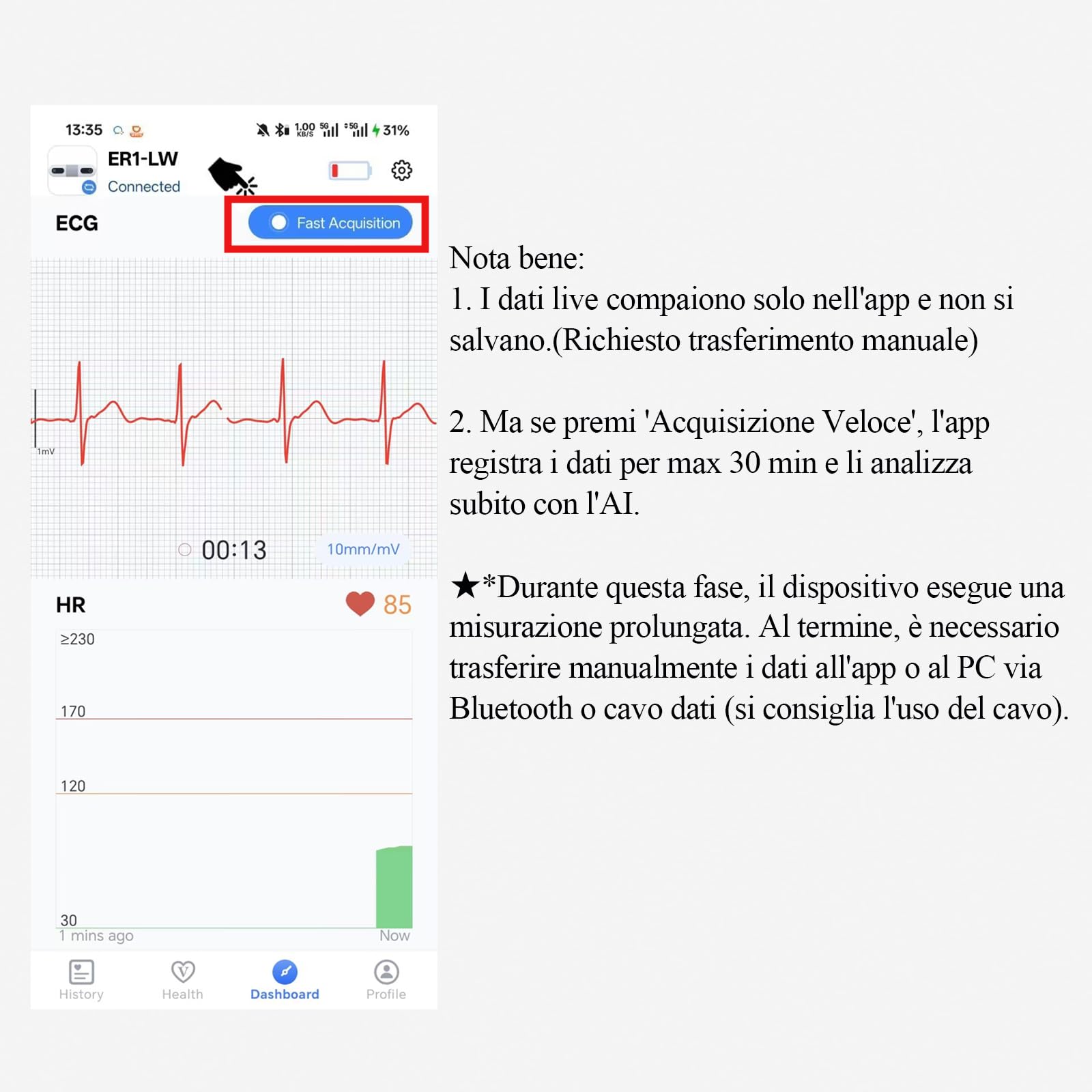 CheckMe ER1-LW Monitor ECG Portatile per 24 Ore per Uso Domestico, Analisi ECG AI Holter ECG con Schermo OLED, Funzione Marcatore Evento ECG, Compatibile con Elettrodi a scatto da 4 mm