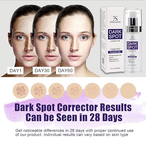 Miniatura 5 de Actualizado Eliminador de manchas oscuras para cara, suero brillante corrector de manchas oscuras con niacinamida retinol y vitamina C, removedor