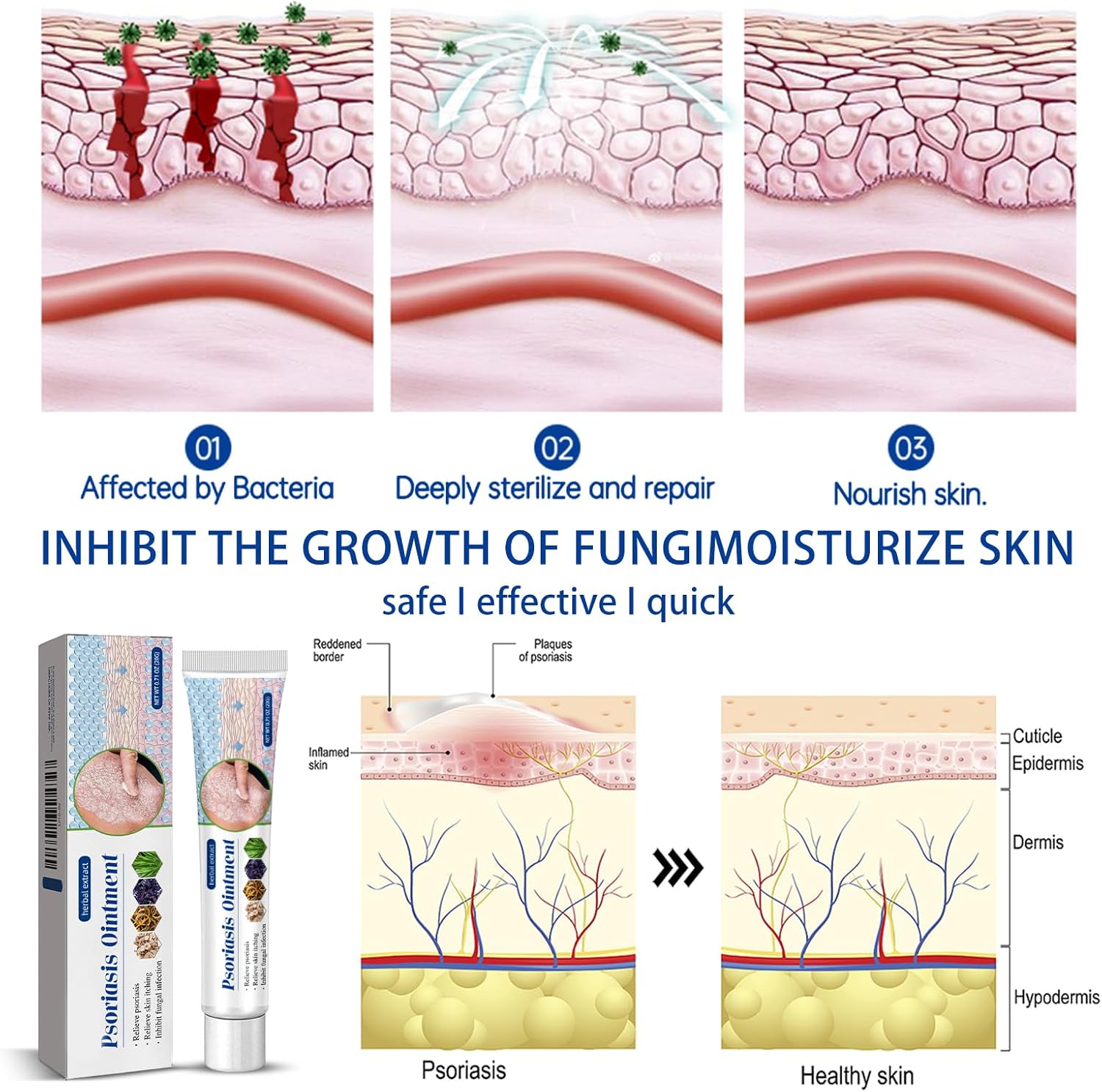 Antifungal Cream for Jock Itch: Anti Fungal Cream for Itchy Skin Relief Extra Strength - Ringworm Treatment for Humans - Image 5