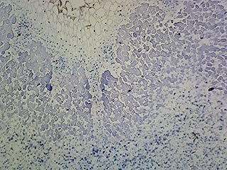 Root Legume Nodule - Microscope Slide