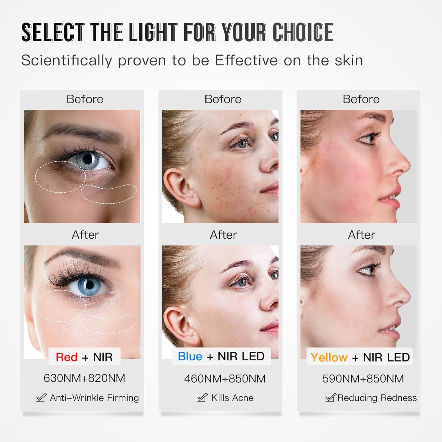 Maschera LED per il Viso, Terapia della Luce Rossa, 3 Colori con Luce nel Vicino Infrarosso, Dispositivo per la Cura per Tutti i Tipi di Pelle a Casa (Nero)