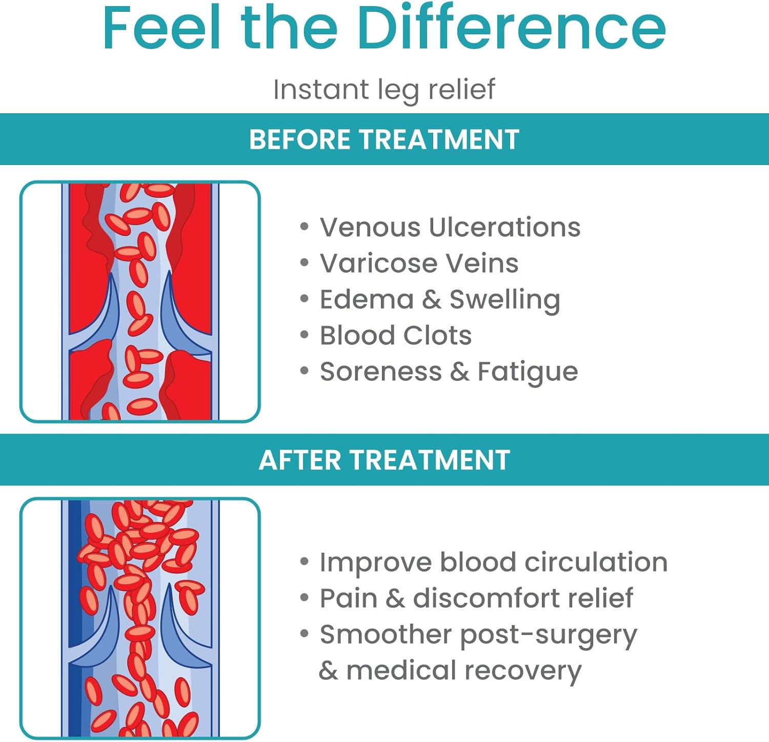 Vive Medical Compression Stockings - 20-30mmHg Knee High Socks for Varicose Veins - Support Stockings for Women/Men - Graduated Compression For Anti Embolism, Post Surgery, Swelling, Soreness - Image 7