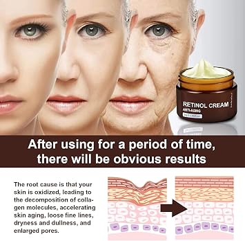 Retinol Anti Aging Wrinkle Removal Skin Firming Cream, Retinol Body Lotion Firming Moisturizer, Anti-Aging Face Cream for Lines and Wrinkles, 30g (1pcs)