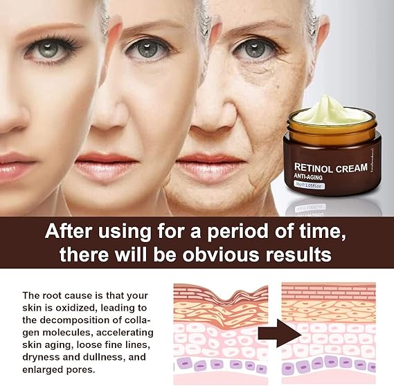 Retinol Anti Aging Wrinkle Removal Skin Firming Cream, Retinol Body Lotion Firming Moisturizer, Anti-Aging Face Cream for Lines and Wrinkles, 30g (1pcs)